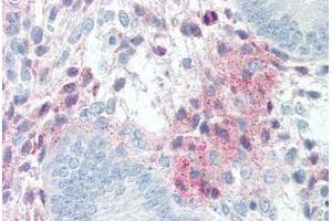 anti-serpin Peptidase Inhibitor, Clade F (Alpha-2 Antiplasmin, Pigment Epithelium Derived Factor), Member 1 (SERPINF1) (AA 196-347) antibody