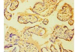 Immunohistochemistry of paraffin-embedded human placenta tissue using ABIN7149358 at dilution of 1:100 (BMX antibody  (AA 65-280))