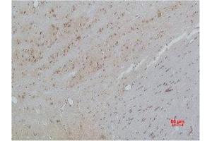 Immunohistochemistry (IHC) image for anti-Calcium Channel, Voltage-Dependent, beta 3 Subunit (CACNB3) antibody (ABIN7189154)
