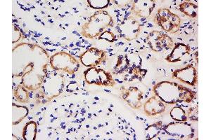 Formalin-fixed and paraffin embedded human kidney labeled with Anti-AMPK beta 1 Polyclonal Antibody, Unconjugated  at 1:500 followed by conjugation to the secondary antibody and DAB staining (PRKAB1 antibody  (AA 2-100))