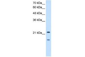 MMP7 antibody used at 2. (MMP7 antibody)