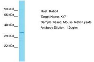 Image no. 1 for anti-Kruppel-Like Factor 7 (Ubiquitous) (KLF7) (AA 133-182) antibody (ABIN6750308) (KLF7 antibody  (AA 133-182))