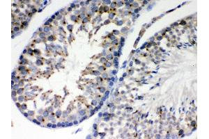Immunohistochemistry (IHC) image for anti-Estrogen Receptor Binding Site Associated, Antigen, 9 (EBAG9) (AA 31-213) antibody (ABIN3043569)