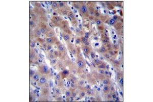 Immunohistochemistry analysis in Formalin Fixed, Paraffin Embedded Human liver tissue stained with FADS2 Antibody (N-term) followed by peroxidase conjugation of the secondary antibody and DAB staining. (FADS2 antibody  (N-Term))