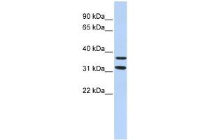WB Suggested Anti-ZNF254 Antibody Titration:  0.