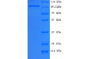 Parkinson Protein 2, E3 Ubiquitin Protein Ligase (Parkin) (PARK2) (AA 1-465), (full length) protein (His-SUMO Tag)
