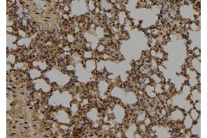 ABIN6274019 at 1/100 staining Mouse lung tissue by IHC-P. (ID1 antibody  (Internal Region))