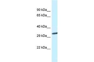 Western Blotting (WB) image for anti-Glycine N-Methyltransferase (GNMT) (C-Term) antibody (ABIN2781321)
