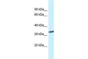 WB Suggested Anti-Gnmt Antibody   Titration: 1. (GNMT antibody  (C-Term))