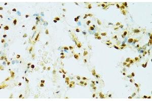 Immunohistochemistry of paraffin-embedded Rat lung using RCC1 Polyclonal Antibody at dilution of 1:100 (40x lens).