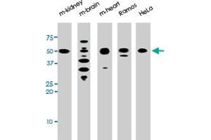 The park polyclonal antibody  is used in Western blot to detect park in, from left to right, mouse kidney, mouse brain, mouse heart, Ramos, and HeLa tissue lysates . (Parkin antibody  (N-Term))