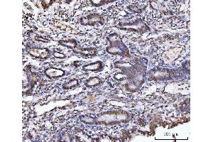 IHC analysis of UBA6 using anti-UBA6 antibody (ABIN7602559). (UBA6 antibody  (AA 85-1033))