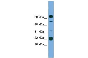 WB Suggested Anti-TMEM107 Antibody Titration:  0. (TMEM107 antibody  (N-Term))