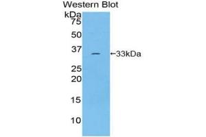 Detection of Recombinant ROR1, Human using Polyclonal Antibody to Receptor Tyrosine Kinase Like Orphan Receptor 1 (ROR1) (ROR1 antibody  (AA 540-795))