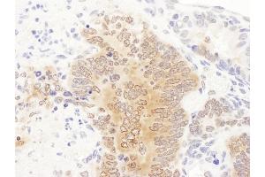 Immunohistochemistry (IHC) image for anti-Phosphoribosylglycinamide Formyltransferase (GART) (AA 200-250) antibody (ABIN7455020) (GART antibody  (AA 200-250))