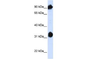 HSPA4 antibody used at 1 ug/ml to detect target protein.