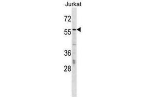 CBFA2T2 Antibody (N-term) western blot analysis in Jurkat cell line lysates (35µg/lane). (CBFA2T2 antibody  (N-Term))