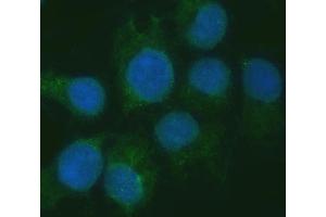 IF analysis of RGS7 using anti-RGS7 antibody (ABIN7599430). (RGS7 antibody  (AA 1-483))