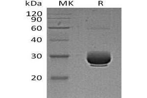 Western Blotting (WB) image for Angiopoietin-Like 3 (ANGPTL3) protein (His tag) (ABIN7320853) (ANGPTL3 Protein (His tag))