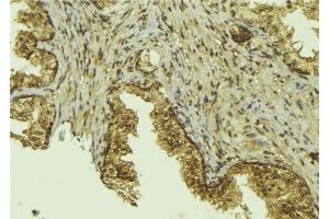 ABIN6276536 at 1/100 staining Mouse colon tissue by IHC-P. (CTCF antibody  (C-Term))