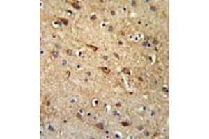 Formalin fixed, paraffin embedded brain tissue stained with RGR Antibody  followed by peroxidase conjugation of the secondary antibody and DAB staining. (RGR antibody  (Middle Region))