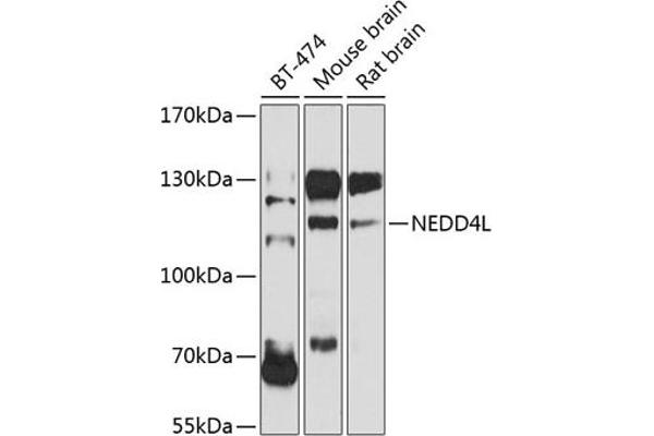 NEDD4-2 抗体  (AA 836-955)