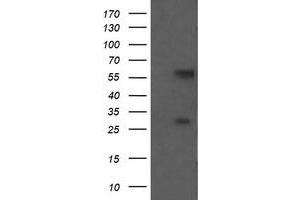 Image no. 1 for anti-Chaperonin Containing TCP1, Subunit 8 (Theta)-Like 2 (CCT8L2) antibody (ABIN1497483) (CCT8L2 antibody)