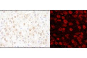 Immunohistochemistry (IHC) image for anti-Poly (ADP-Ribose) Polymerase 1 (PARP1) (AA 50-100) antibody (ABIN7455230) (PARP1 antibody  (AA 50-100))