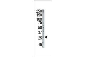 Western blot analysis of anti-Bok BH3 domain Pab (ABIN388103 and ABIN2846206) in HL-60 cell lysate. (BOK antibody  (AA 60-90))