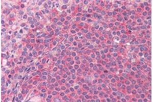 Human Spleen: Formalin-Fixed, Paraffin-Embedded (FFPE) (SH3GLB1 antibody  (AA 1-366))