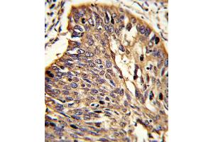 Immunohistochemistry (IHC) image for anti-Myeloid Differentiation Primary Response Gene (88) (MYD88) antibody (ABIN2915923) (MYD88 antibody)