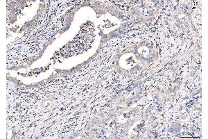 IHC analysis of CD163 using anti-CD163 antibody (ABIN5693082).