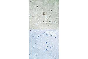Immunohistochemical staining of human brain tissue by NTRK2 (phospho Y706/Y707) polyclonal antibody  without blocking peptide (A) or preincubated with blocking peptide (B) under 1:50-1:100 dilution. (TRKB antibody  (pTyr706, pTyr707))