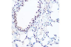 Immunohistochemistry of paraffin-embedded mouse lung using S Rabbit pAb (ABIN6128698, ABIN6147392, ABIN6147393 and ABIN6215703) at dilution of 1:100 (40x lens). (SART3 antibody  (AA 664-963))