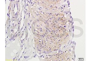 Formalin-fixed and paraffin embedded rat uterine myoma labeled with Rabbit Anti-ER-beta Polyclonal Antibody (ABIN725735) at 1:200 followed by conjugation to the secondary antibody and DAB staining. (TACR3 antibody  (AA 151-250))