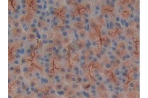 Immunohistochemistry (IHC) image for anti-Mucin 1 (MUC1) (AA 404-655) antibody (ABIN7429049)