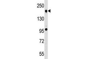 TET2 antibody western blot analysis in A549 lysate. (TET2 antibody  (AA 528-554))