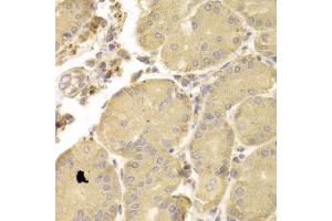 Immunohistochemistry of paraffin-embedded human stomach using ATG7 antibody (ABIN6292614) at dilution of 1:100 (40x lens). (ATG7 antibody)