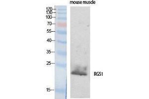 Western Blotting (WB) image for anti-Regulator of G-Protein Signaling 1 (RGS1) (Internal Region) antibody (ABIN3177204) (RGS1 antibody  (Internal Region))