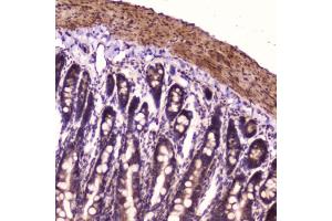 IHC testing of FFPE rat small intestine with p65 antibody at 2ug/ml. (NF-kB p65 antibody  (AA 99-551))