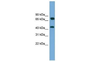 MAT2A antibody used at 1 ug/ml to detect target protein. (MAT2A antibody  (Middle Region))