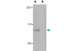 Western blot analysis of GP6 in mouse brain lysate with GP6 polyclonal antibody  at 1 ug/mL in either the absence or (B) the presence of blocking peptide. (GP6 antibody  (Internal Region))