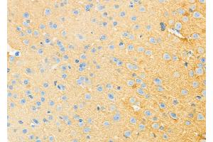 ABIN6264577 and ABIN6273305 at 1/100 staining Mouse brain tissue by IHC-P.