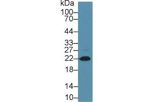 Western Blot; Sample: Rat Heart; Primary Ab: 1µg/ml Mouse Anti-Rabbit NT-ProBNP Antibody Second Ab: 0. (NT-ProBNP antibody)