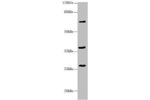 Western blot All lanes: GNS antibody at 3. (GNS antibody  (AA 293-552))