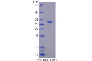 SDS-PAGE analysis of Human PGM2 Protein.