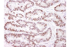 Immunohistochemistry (IHC) image for anti-Protein Kinase, DNA-Activated, Catalytic Polypeptide (PRKDC) (AA 2100-2150) antibody (ABIN7453820)