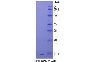SDS-PAGE analysis of Mouse Serum Amyloid A Protein.