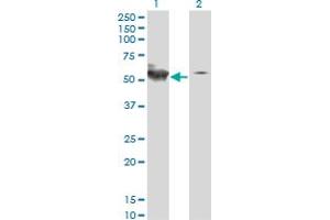 Western Blot analysis of STK38 expression in transfected 293T cell line by STK38 monoclonal antibody (M01A), clone 2G8-1F3. (STK38 antibody  (AA 1-465))