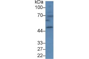 Detection of CPB1 in Mouse Spleen lysate using Polyclonal Antibody to Carboxypeptidase B1, Tissue (CPB1) (CPB1 antibody  (AA 109-415))